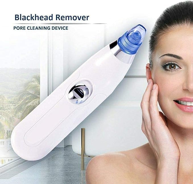4-in-1 Electric Blackhead & Whitehead Remover Vacuum | Pore Cleaner Acne & Pimple Extraction Skin Care Device for Men & Women (White)