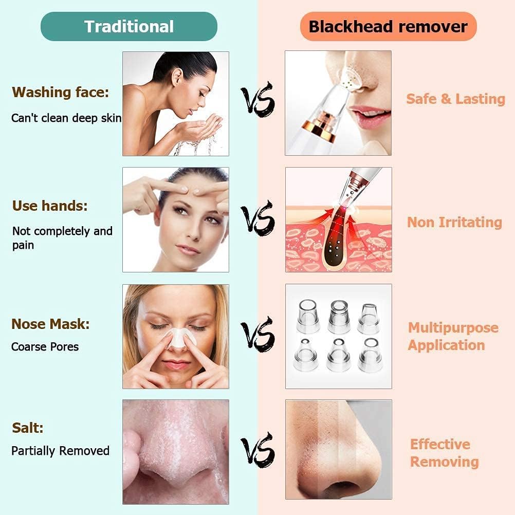 6-in-1 Blackhead Remover Vacuum | Electric Pore Cleaner & Acne Suction Tool (White) – CozyEdge