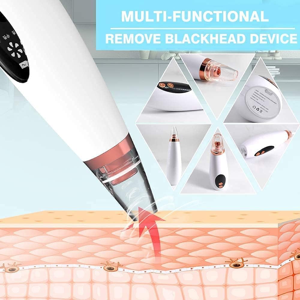 6-in-1 Blackhead Remover Vacuum | Electric Pore Cleaner & Acne Suction Tool (White) – CozyEdge