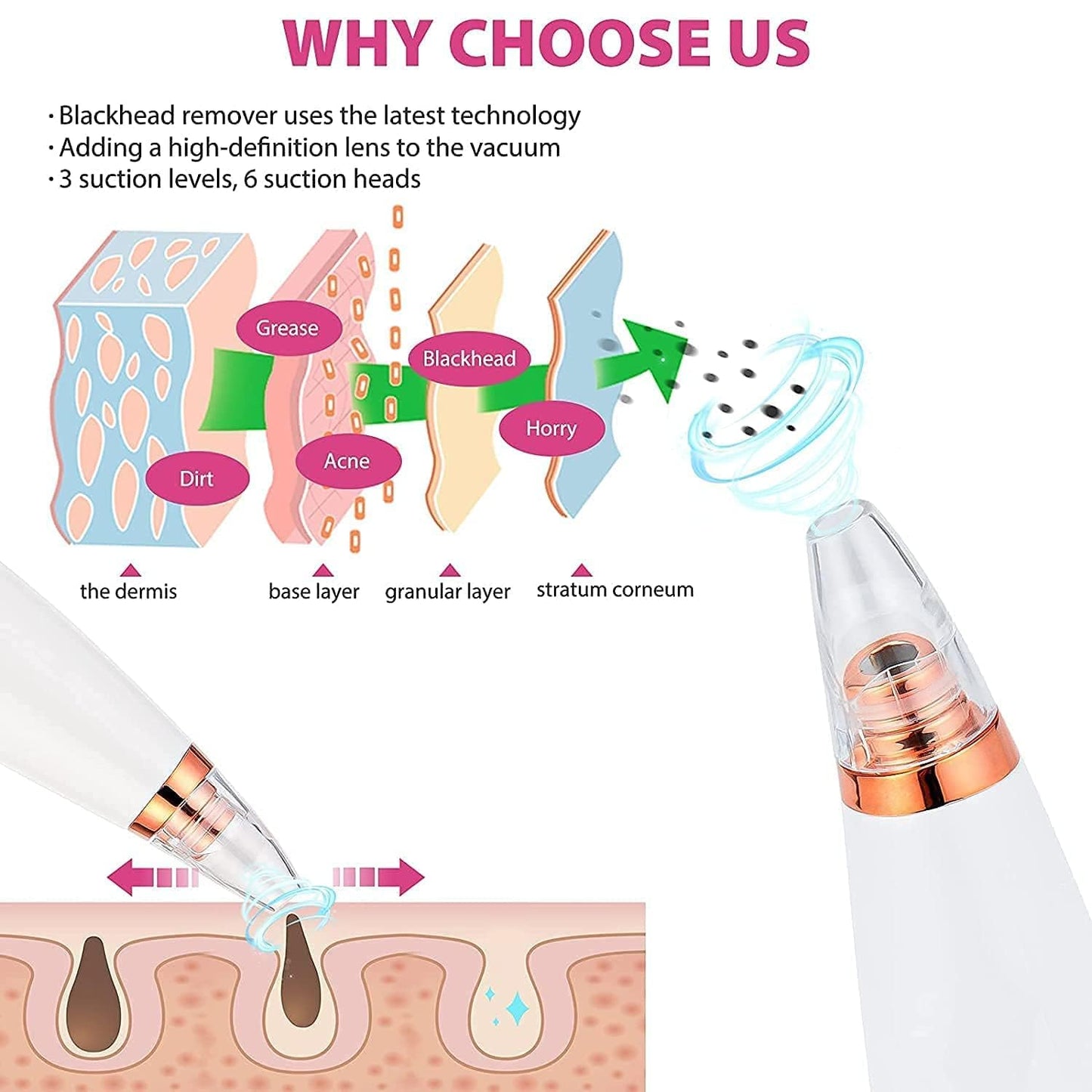 6-in-1 Blackhead Remover Vacuum | Electric Pore Cleaner & Acne Suction Tool (White) – CozyEdge